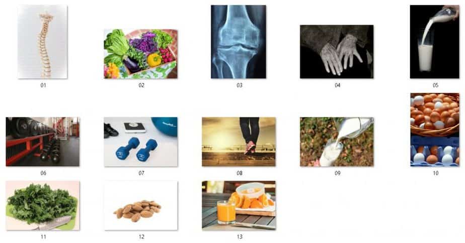 Healthy Bones Royalty Free Images